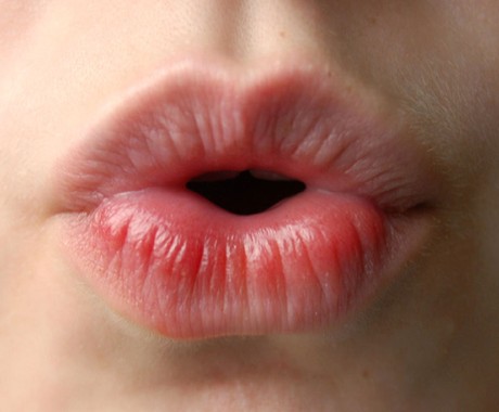 O mau hálito pode ser indicação de algum distúrbio grave (Foto: SXC.hu)